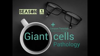 Giant Cells Pathology  All 10 types  Reed Sternberg Cells  Physiology [upl. by Bina]