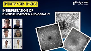 Optometry Series Episode8 Interpretation of Fundus Fluroscein Angiography [upl. by Nolaf223]