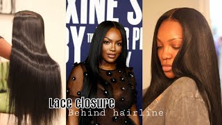 DIY Lace closure behind hairline wig [upl. by Nee69]