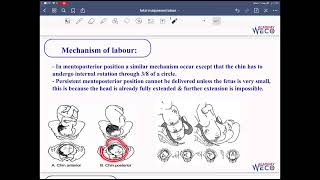 Obstetrics Fetal malpresentation 2 [upl. by Namar]