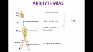 Treatment of Arrhythmia Pharmacology  Antiarrhythmic Drugs Pharmacology Mnemonics  Part 1 [upl. by Marina62]