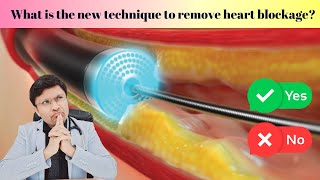 quotLaser Angioplasty Breakthrough Technique for Heart Blockage Removal 💥 [upl. by Nylitak]