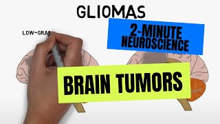 2Minute Neuroscience Brain tumors [upl. by Celene]