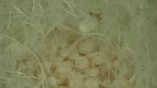 Disease clip  Sheep scab mite [upl. by Ansela]