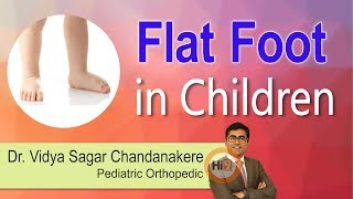 Flat foot in Children  Dr Vidya Sagar Chandanakere  Pediatric Orthopedic  Hi9 [upl. by Leilamag]