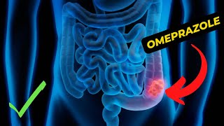 Omeprazole An In Depth Guide To Its Uses Benefits And Side Effects [upl. by Camella]