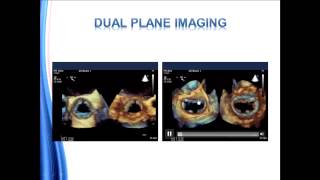 Guidelines for Performing a Comprehensive Transesophageal Echocardiographic Examination [upl. by Cila64]