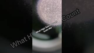 This is what high sperm count looks like  fertility infertility sperm semenhealth [upl. by Herbie]