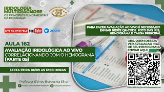 AVALIAÇÃO IRIDOLÓGICA AO VIVO COM ÊNFASE NO HEMOGRAMA PARTE 05 [upl. by Socem]