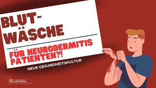 Blutwäsche Eine Behandlungsoption für Neurodermitis Patienten [upl. by Pollard]