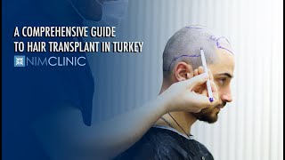 A Comprehensive Guide to Hair Transplant in Turkey [upl. by Zzaj]