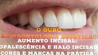 🛑Aumento incisal Resinas utilizadas para criar opalescencia e halo incisalMarcas e opções [upl. by Mayda40]