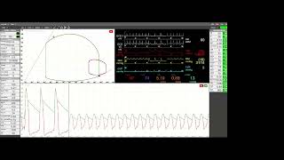 A Cardioprotective Mindset Myocardial Energetics and Ventricular Unloading in Cardiogenic Shock [upl. by Yemiaj]