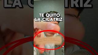 TE QUITO LA CICATRIZ asmr shorts asmrvideo comedia [upl. by Aihsotan]