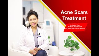 Acne Scar Treatment  Dr Tasnim Khan [upl. by Yduj]