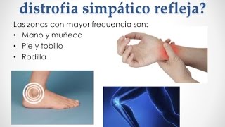 Sindrome de Sudeck  Recomendaciones de Rehabilitacion [upl. by Qiratla596]