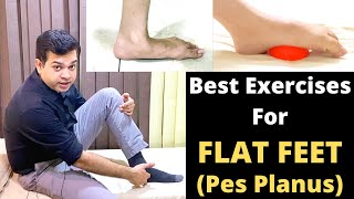 Treatment For Flat Feet Pes Planus Flat Foot Exercises Foot Pain Treatment Foot Arch Exercises [upl. by Blalock]