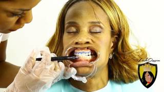 TEETH WHITENING TUTORIAL How to Start a TEETH Whitening Business amp Is Teeth Whitening Legal [upl. by Arretnahs]