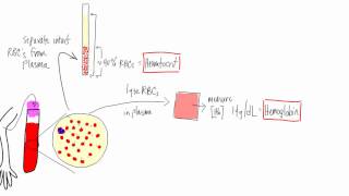 Anemia Basic lab tests  hematocrit hemoglobin reticulocyte MCV morphology [upl. by Oguh723]