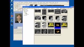 CBCT Integration to Carestream amp J Morita in TDO Software [upl. by Rock139]