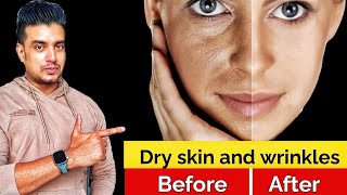 Dry skin and wrinkles  Glowing skin Secret  How to remove Wrinkles  Tallow Cream  Dry Skin [upl. by Hanala]