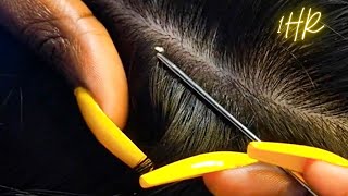 ASMR 1 HR Super Attentive NITPICKING SCALP WHITEHEADS  zoomed [upl. by Aiyot]