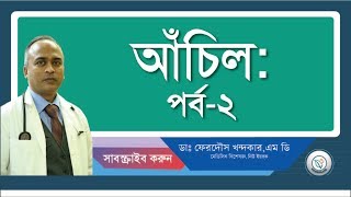 আচিল২ চিকিৎসা [upl. by Arraic]