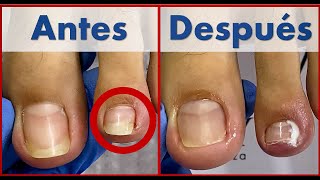 pedicura profunda  que uso para desinfectar y cicatrizar trabajo en cliente  Extreme pedicure [upl. by Boles]