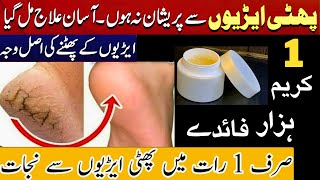 Remove Cracked Heels at home tips amp tricks Get Beautiful Feet Permanently Homemade Cream Remedies [upl. by Anthia]