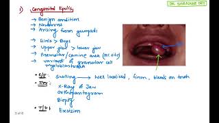 Epulis  Types Clinical Features Treatment  Surgery  Dr Shankar Dey [upl. by Draner]