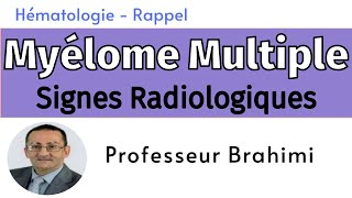 Myélome Multiple Signes Radiologiques [upl. by Lek]