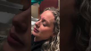 Trying to Smoothen Wrinkles Try Dysport  a Botox Alternative dysport injection viralvideo [upl. by Samantha]