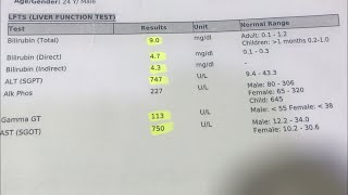 Liver function test result in Urduhindi  LFT Test Result  main test for liver [upl. by Adnilev]