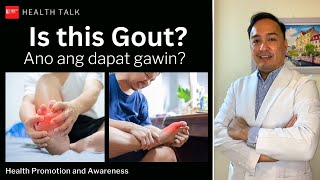 Gout nga ba ito Ano ang dapat gawin [upl. by Ayhay87]