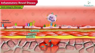 Inflammatory Bowel Disease Pharmacology Lectures [upl. by Siseneg]