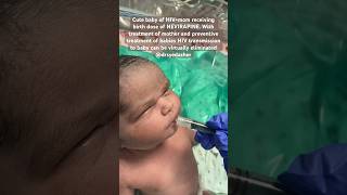 Cute baby of HIVmom receivin NEVIRAPINE cutebaby viral babyshorts newborn allah tiktok [upl. by Tench]