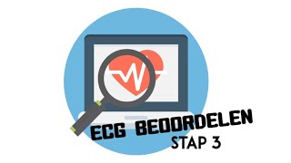 ECG Beoordelen  stap 3 Hartas [upl. by Eliga]