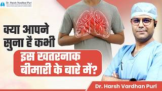 Eventration of Diaphragm Symptoms Diagnosis and Treatment  Dr Harsh Vardhan Puri [upl. by Ophelia]