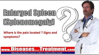 Enlarged Spleen Splenomegaly Where is the pain located  Signs and symptoms [upl. by Iadahs]