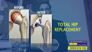 Dr Ashwani Maichand briefs about the Avascular Necrosis of Hip [upl. by Allehc]