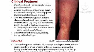 2 Lichenoid Review ✅ Lichen nitidus 🔸 Lichen striatus 🔸 Graft versus host disease by Dr Ahmed Kamel [upl. by Bilac]