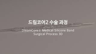 DreamcoreⅡ Medical Silicone Band [upl. by Osmen]