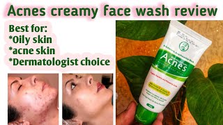 Mentholatum acnes creamy wash for oily and acne skin [upl. by Norean]