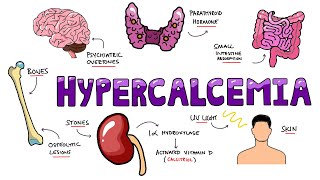 An Approach to Hypercalcemia  Causes Calcium Homeostasis Mechanisms amp Signs and Symptoms Mnemonic [upl. by Anuahsal]