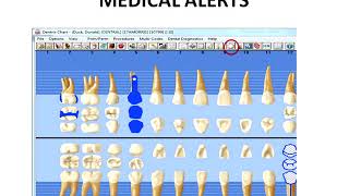 Dentrix Guide [upl. by Mazel244]