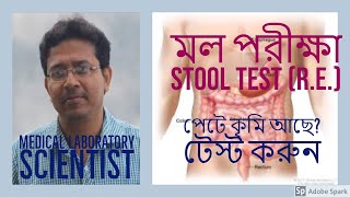 মল পরীক্ষা Stool Test Stool Analysisপায়খানা পরীক্ষা Mol Pariksha [upl. by Yeltsew]