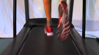 Flatfeet advice for runners [upl. by Edin]