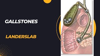 Cholecystitis vs Cholelithiasis vs Cholangitis vs Choledocolithiasis [upl. by Nesahc]