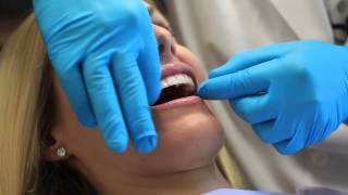 Instructions for Using a Teeth Whitening Strip  Dental Health [upl. by Krongold301]