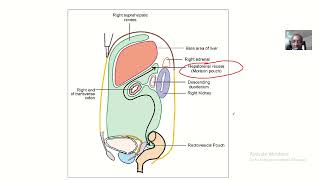 Morrisons pouch  Hepatoranal pouch and how blood fluid accumulates here in ascites  Anatomy [upl. by Adym]